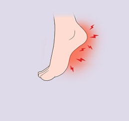 Heel Pain